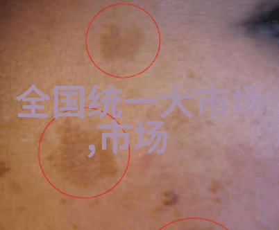 药包材制造设备之谜