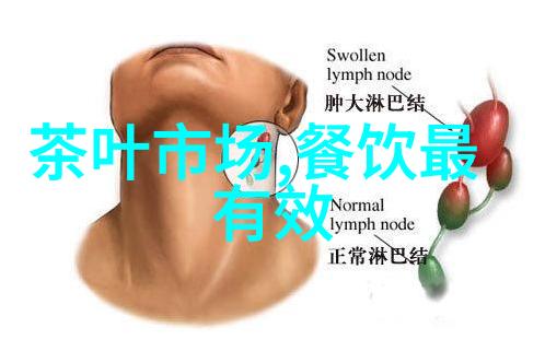 合费职业技术学院如何促进就业市场对技能人才的需求